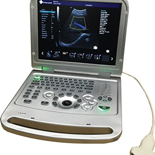 Easywell Portable Color Sonography Ultrasound Scanner